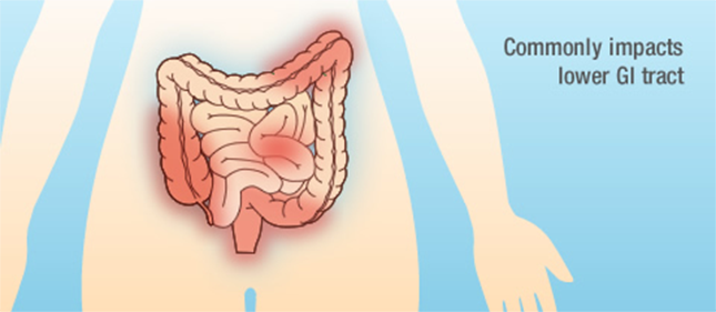 crohn