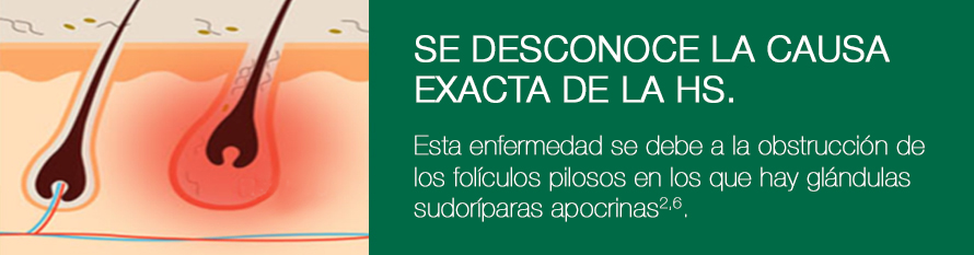 que_es